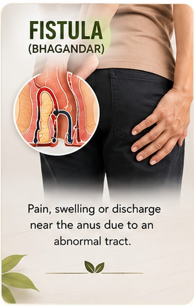 Fistula (bhagandar) symptoms illustration — recurring boil and pus discharge near the anus